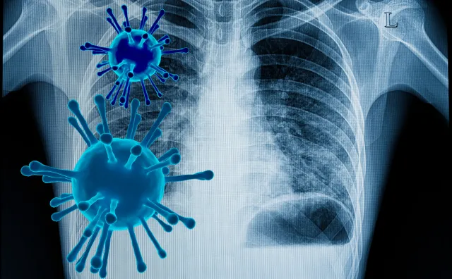 Czy dla COVID-19 da się uzyskać odporność stadną?