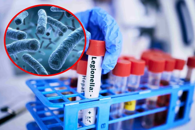 Legionella. Co to za choroba i jakie ma objawy?