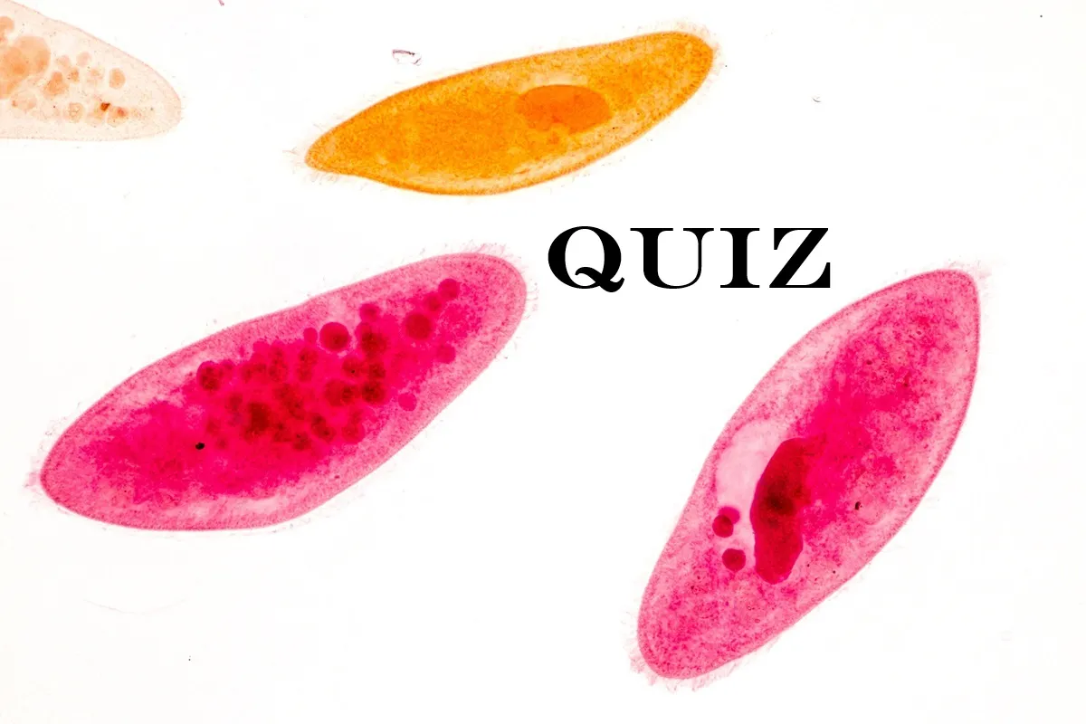 Budowa pantofelka to materiał z 5 klasy szkoły podstawowej. Co z tego pamiętasz? Czy na pewno nic? [TEST]