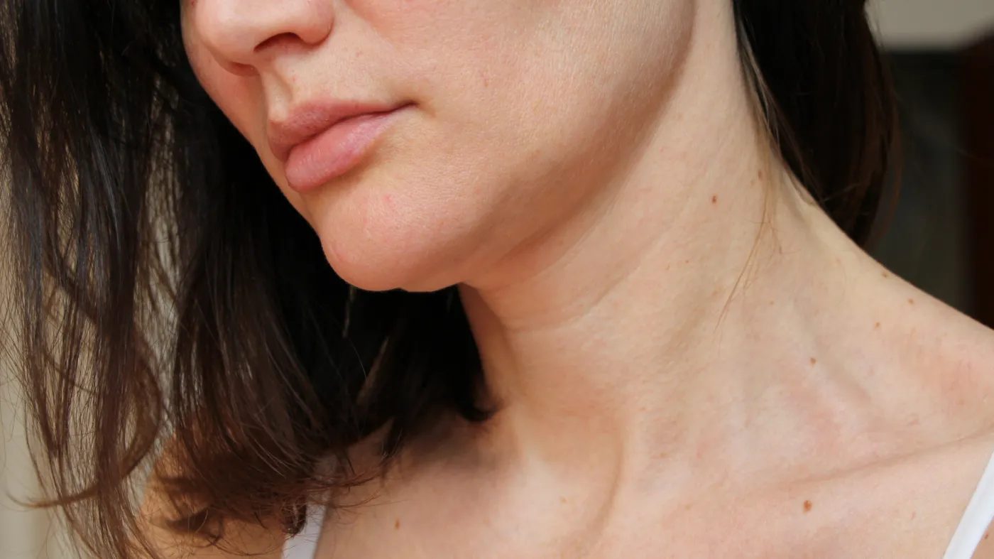 Czy kolagen to cudowny środek na zmarszczki i co naprawdę pomaga zachować młody wygląd?