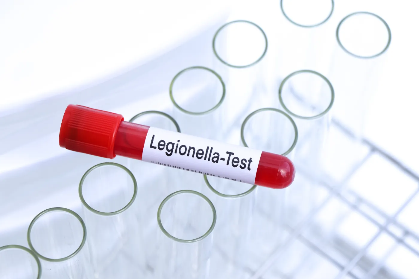 Legionella, legionelloza