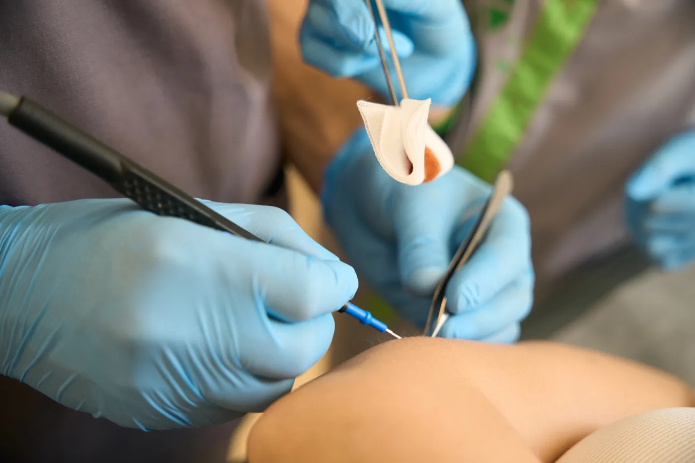 Przerażające dane. Ta grupa jest najbardziej narażona na nowotwory