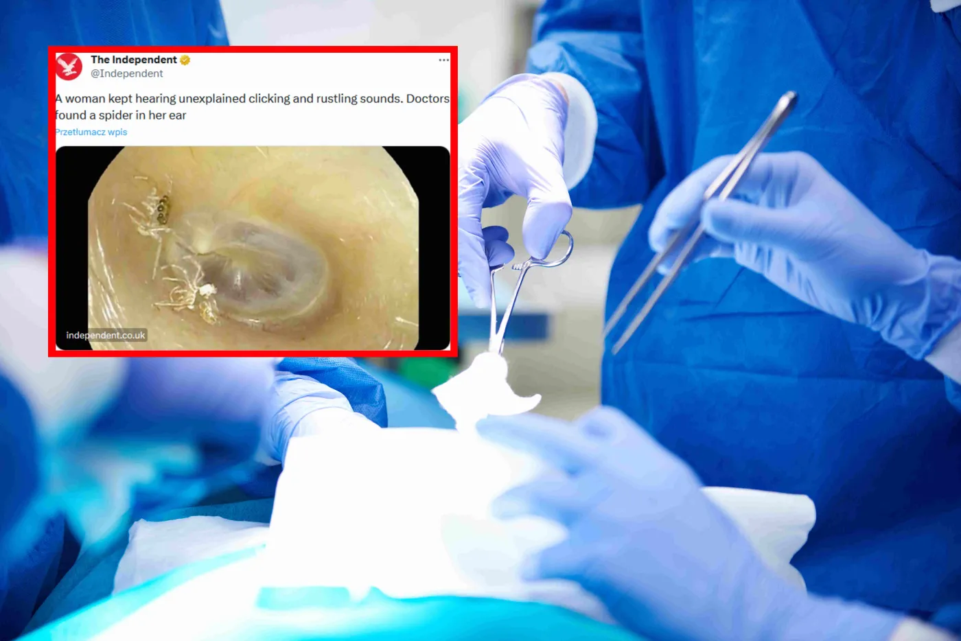 Kobieta słyszała dziwne dźwięki. Lekarze znaleźli w jej uchu coś okropnego