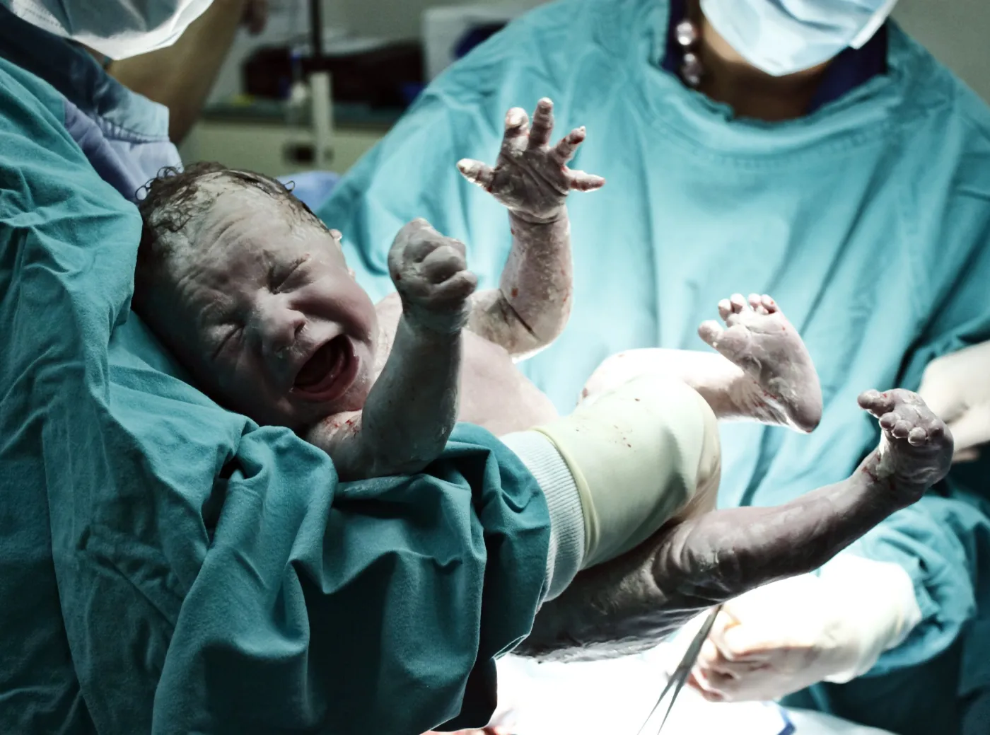 Cesarskie rekordy. "Wysoka liczba cesarskich cięć to nieszczęście"