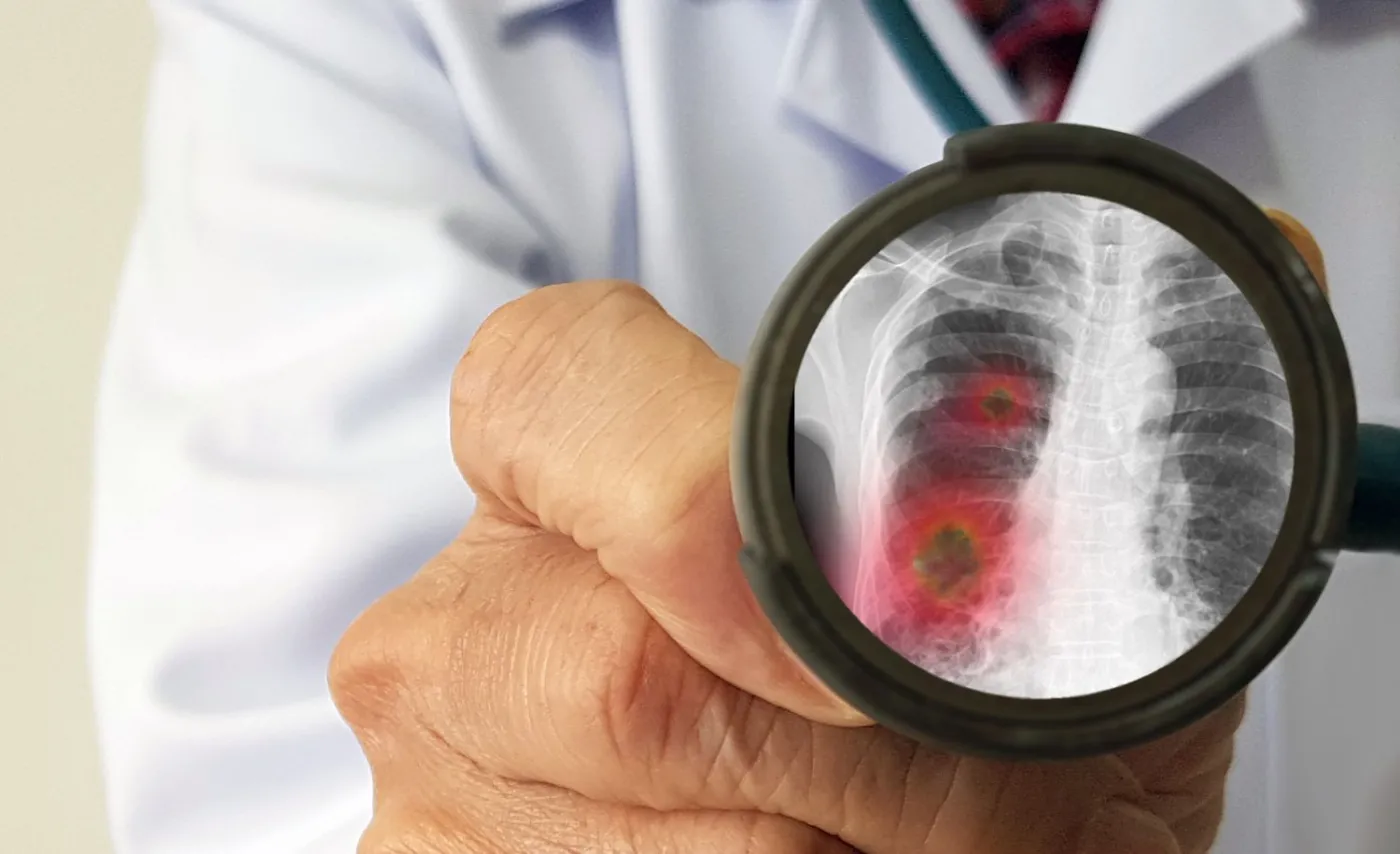 Ekspert: System polityczny Chin przyczynił się do wzrostu skali epidemii