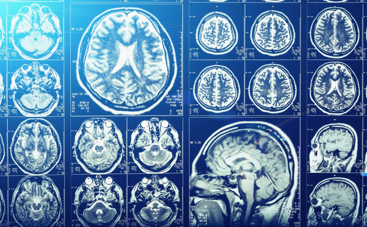 Czaszka jest pełna małych kanalików. Naukowcy wiedzą już, co czego służą
