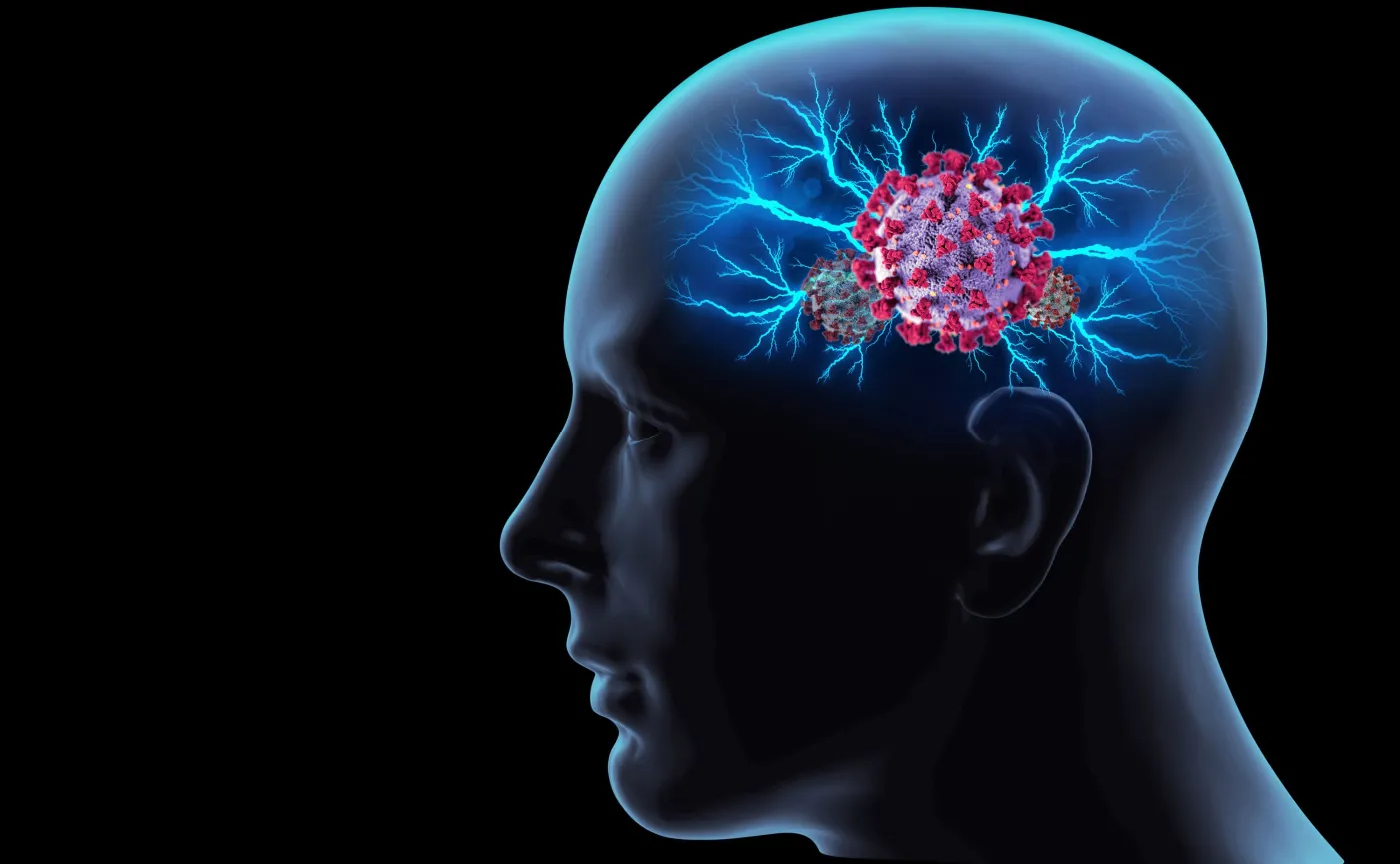 Problemy neurologiczne zgłasza 80 proc. osób hospitalizowanych z powodu COVID-19