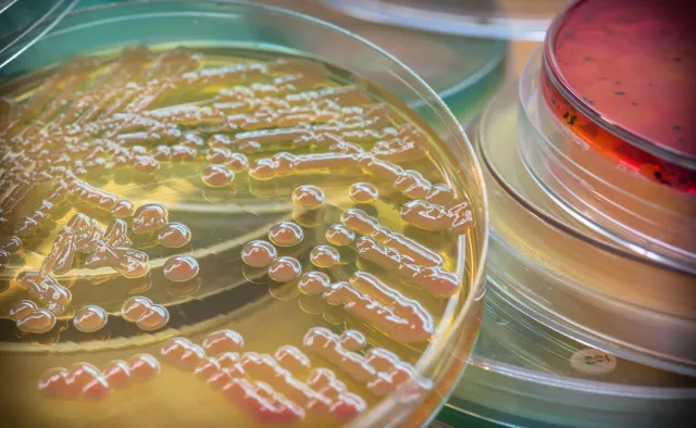 Superbakterie w natarciu. Liczba ich śmiertelnych ofiar wzrośnie lawinowo w nadchodzących latach