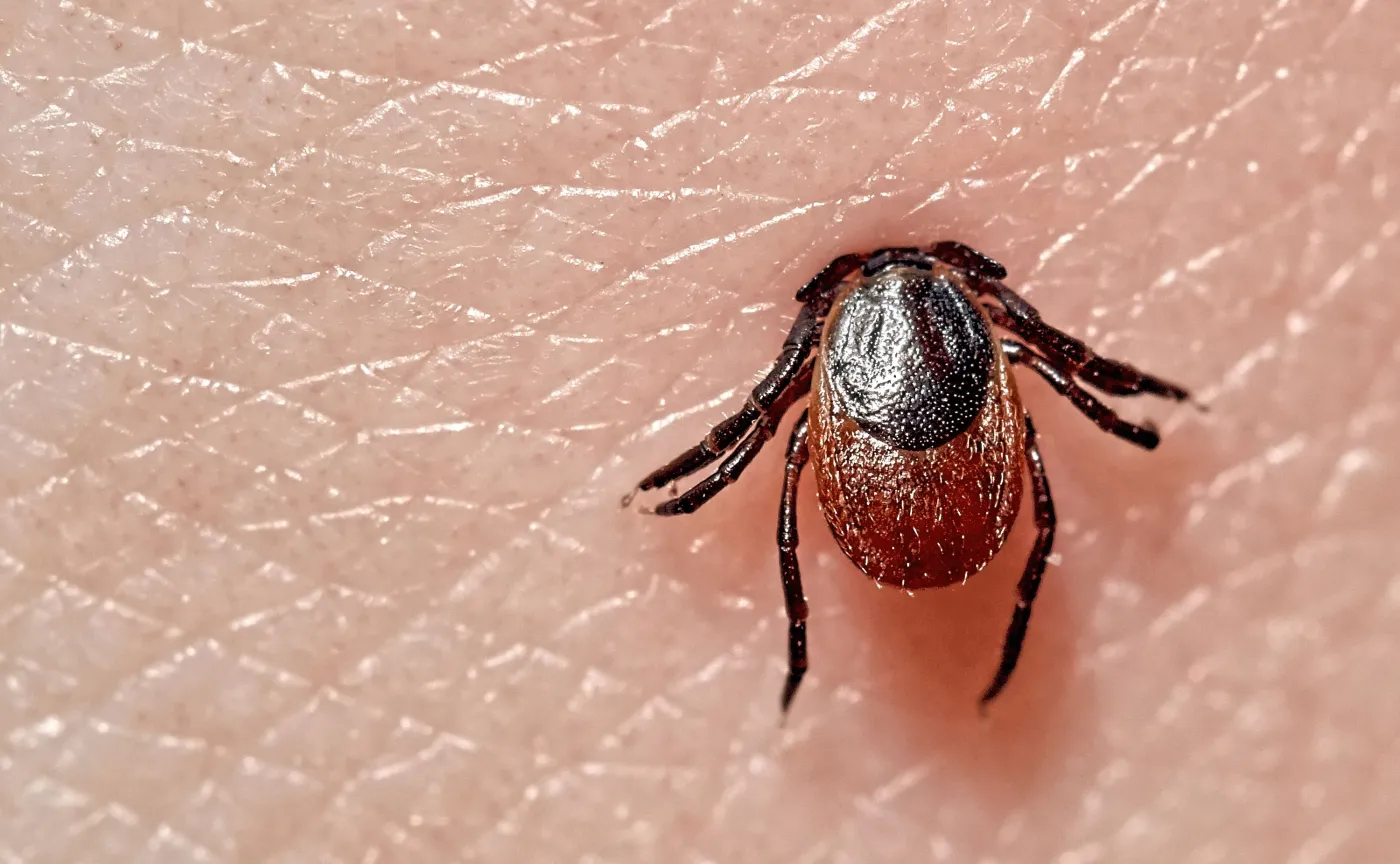 Borelioza w Polsce. Ile przypadków już potwierdzono w tym roku?