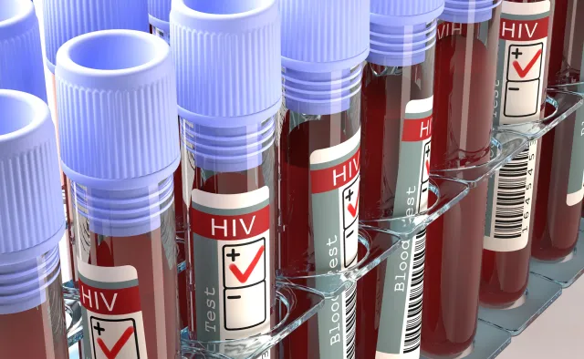 Warchoł: Surowsze karanie za narażenie na zakażenie HIV niż koronawirusem jest niesprawiedliwe