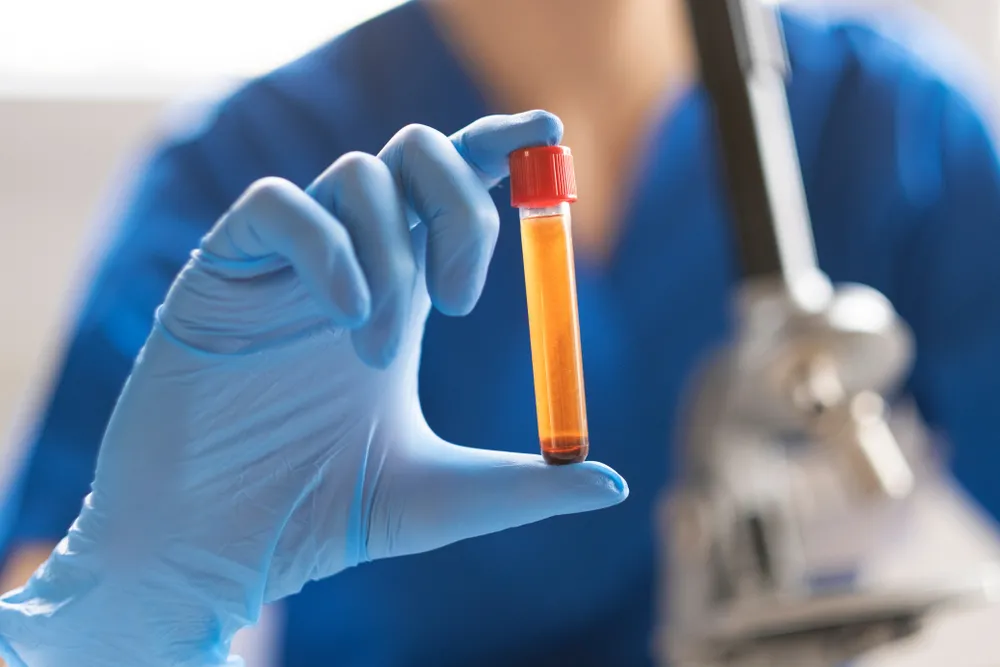 Spółka Inno-Gene ma umowę dystrybucji testów na SARS-CoV-2 we Francji