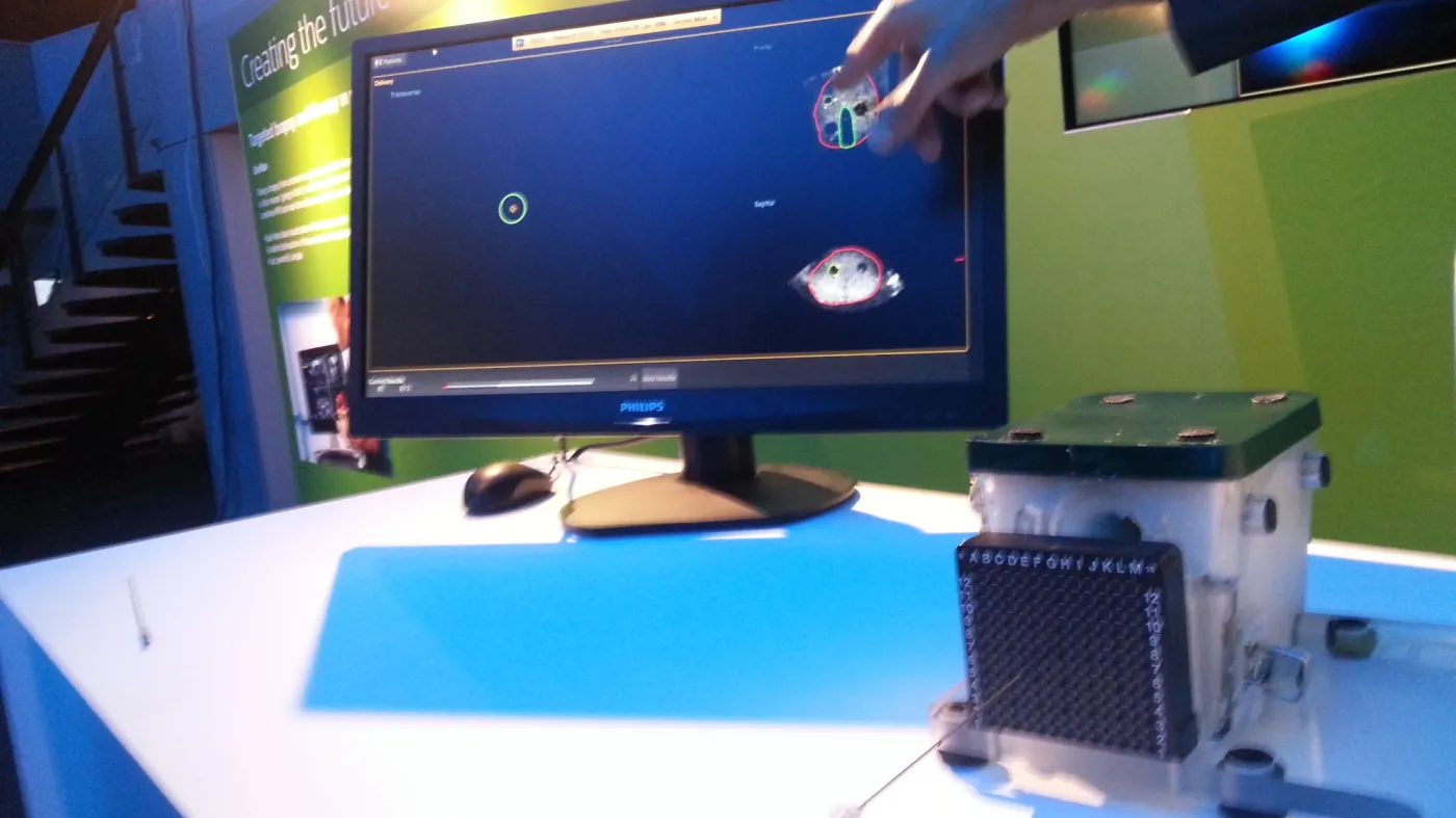 Terapia celowana w leczeniu nowotworów prostaty