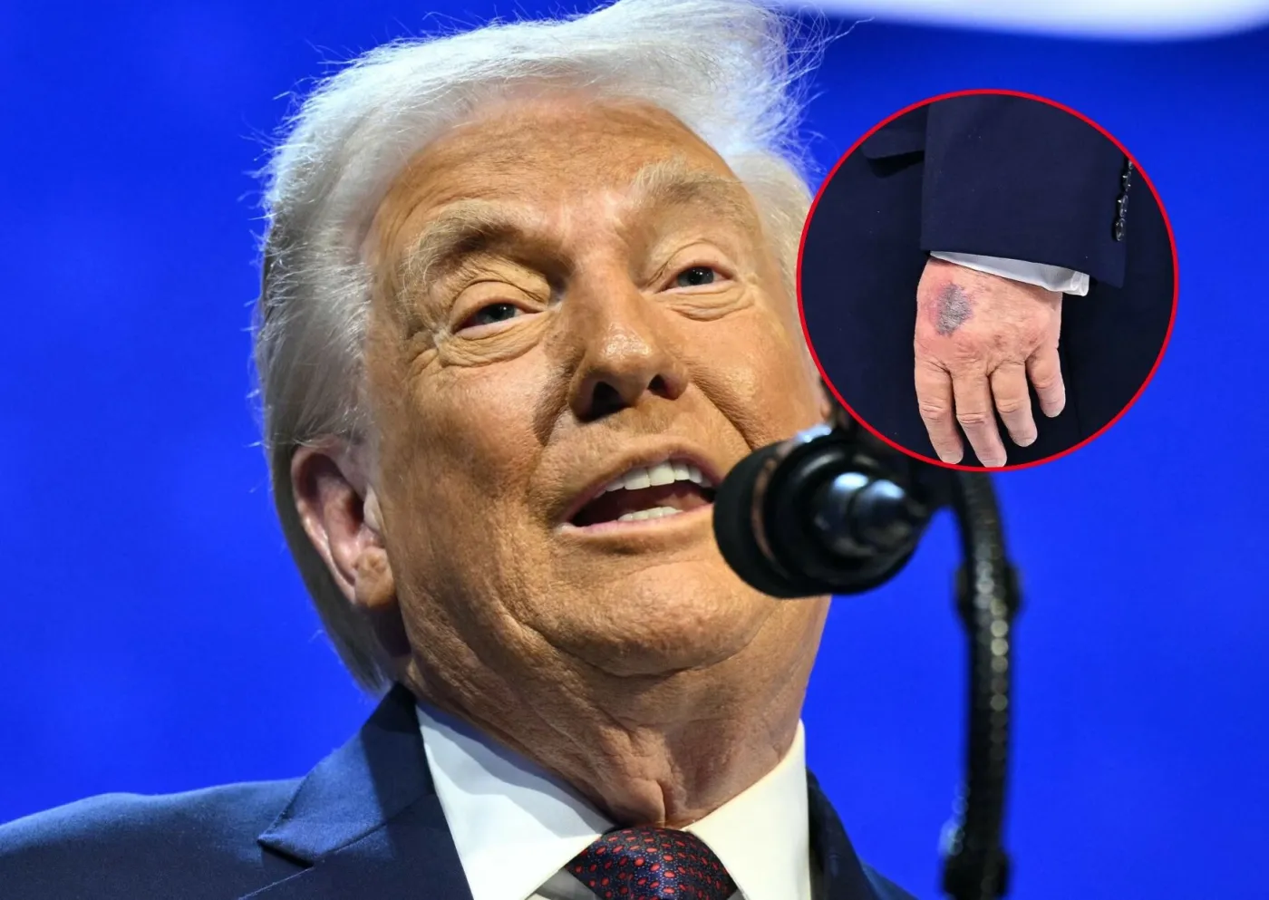 Czy Donald Trump jest chory? Nowe zdjęcia wywołały falę spekulacji o stan zdrowia