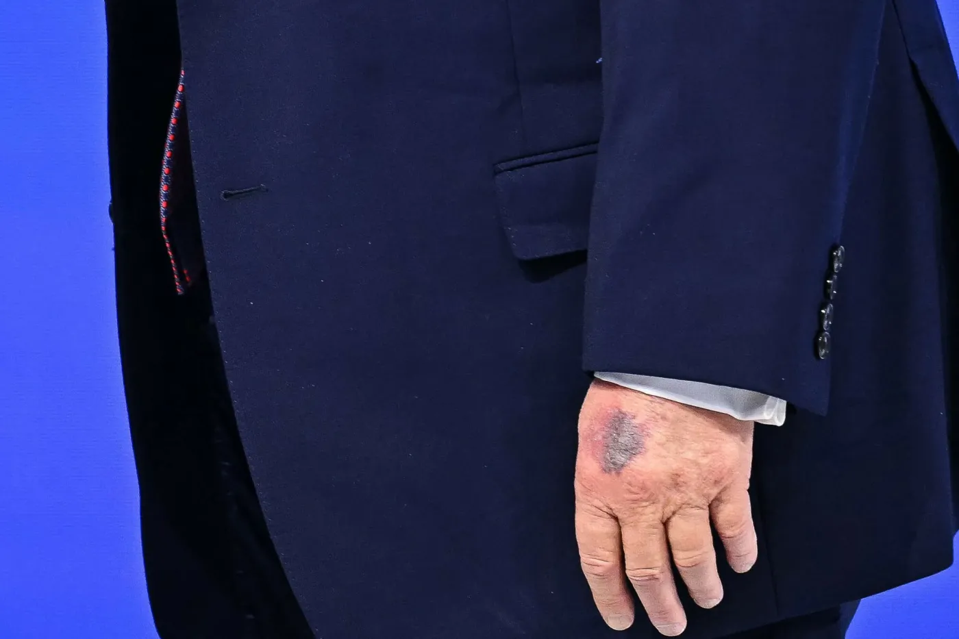 Zdjęcie dłoni Donalda Trumpa wykonane podczas szczytu w Davos