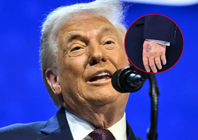 Czy Donald Trump jest chory? Nowe zdjęcia wywołały falę spekulacji o stan zdrowia