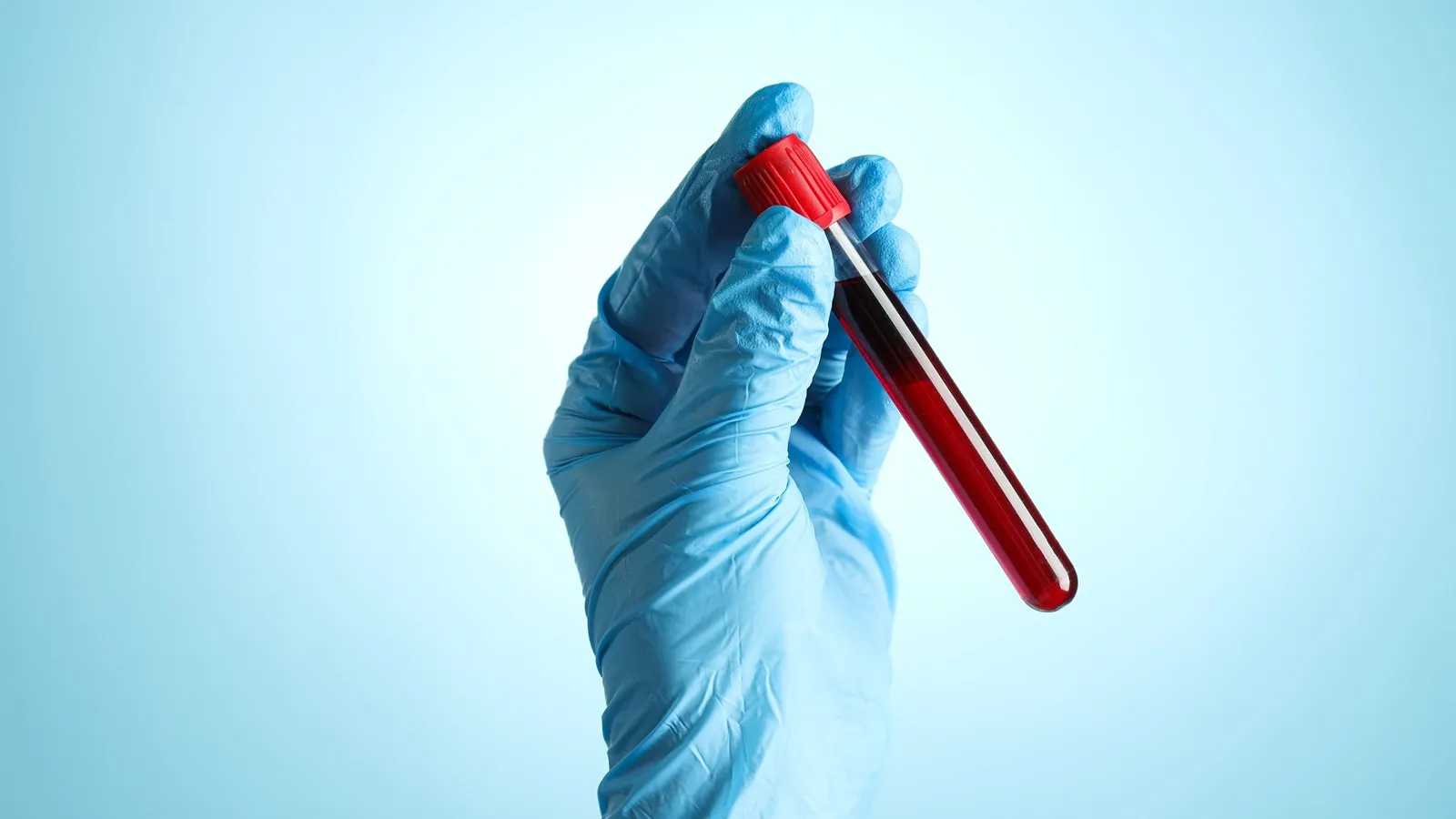 Próbki DNA pacjentów wyjeżdżają z Polski. NIK: państwo nie zna skali procederu