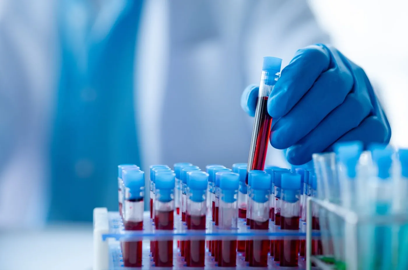 Krwiodawcy nierówno traktowani. Zleceniobiorcy i samozatrudnieni nie doczekają się zmiany przepisów