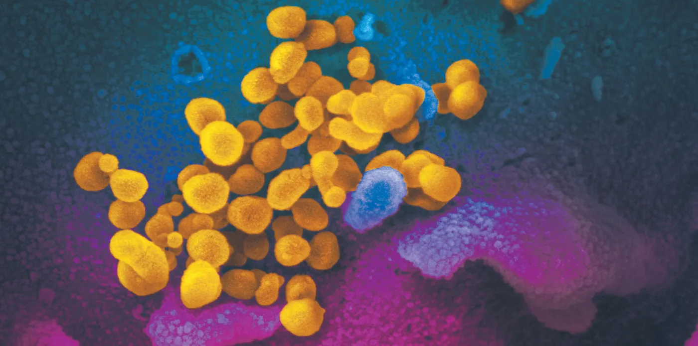 4505963-u76e68-3-coronavirus-fot-20niaid-rml-20-p-16096222.jpg