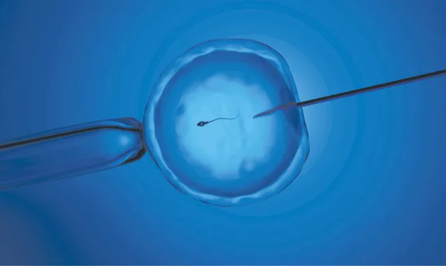 Rozpędzone in vitro. Samorządy inwestują w programy wspomagające dzietność