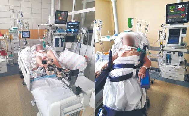 Wczesna mobilizacja nieodzownym elementem leczenia ciężko chorych pacjentów