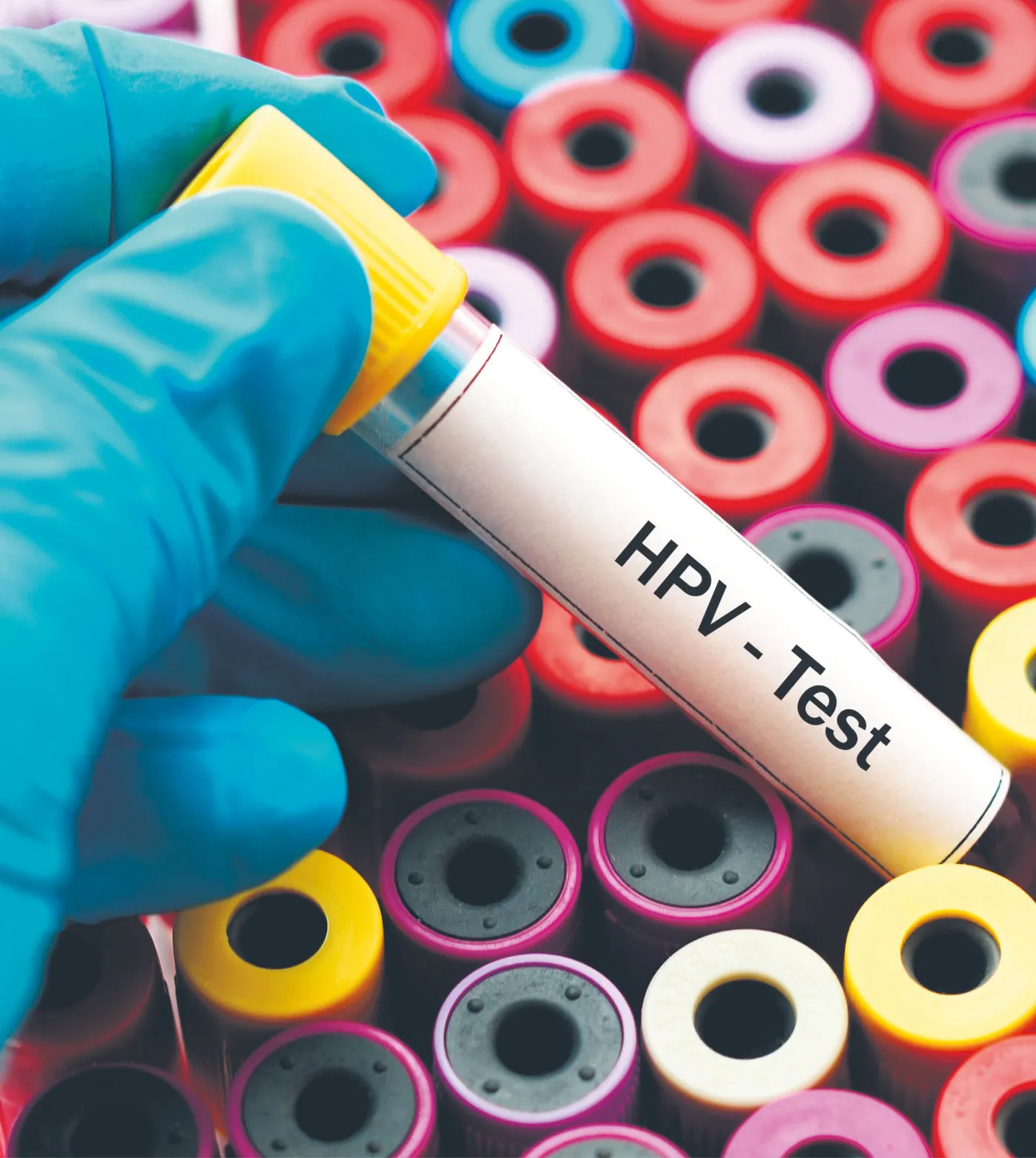 Obronić dzieci przed HPV