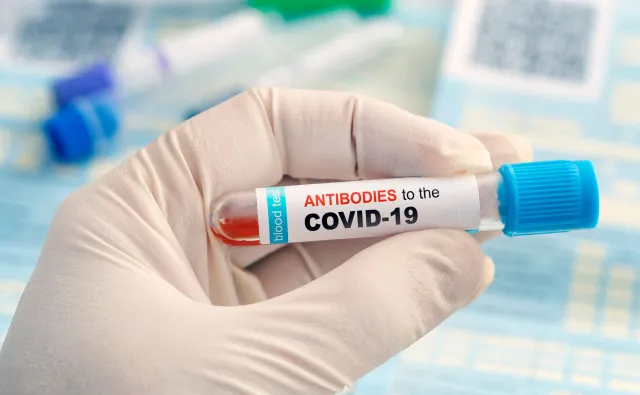 Test na Covid-19 przed przyjściem do pracy? Kolejne pomysły bez konsultacji