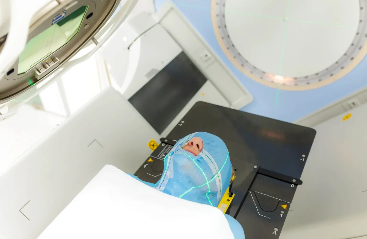 Pacjent w specjalnym unieruchomieniu, przygotowany do teleradioterapii nowotworu głowy