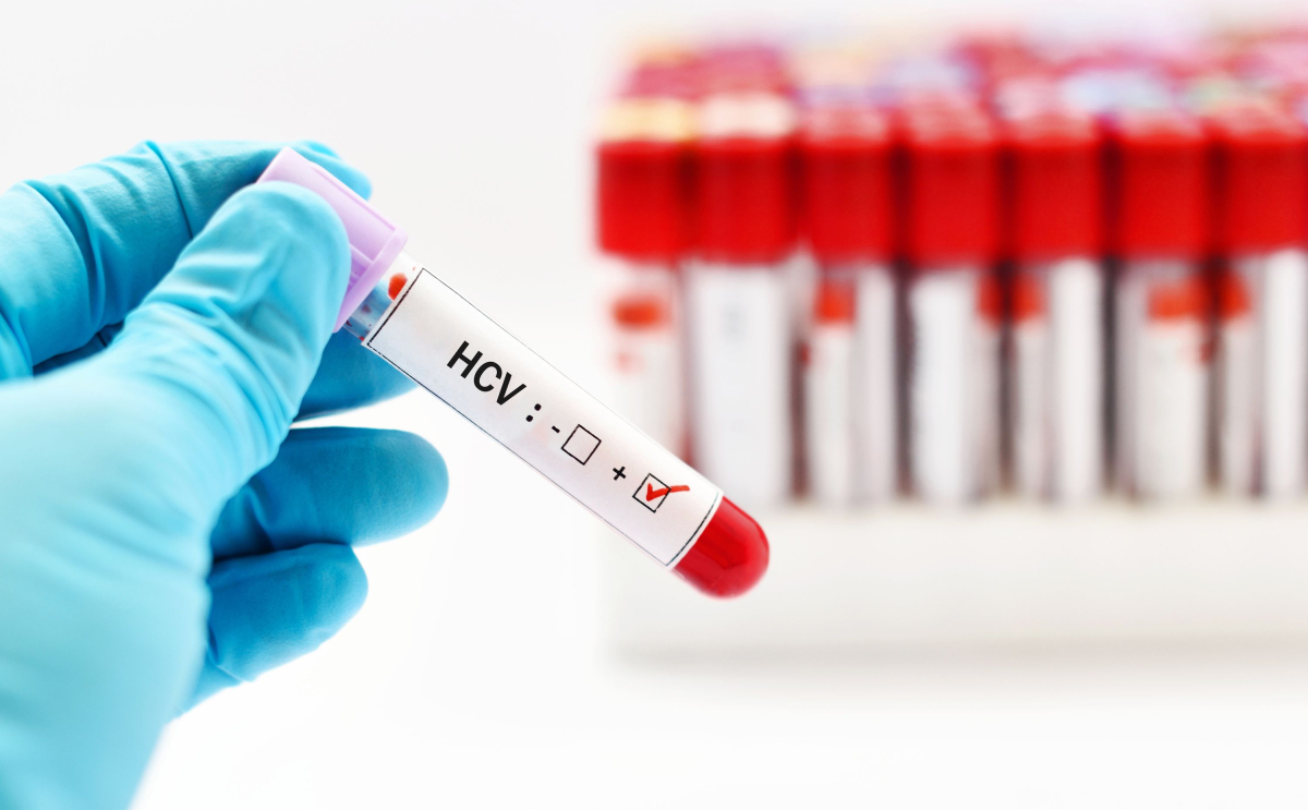 HCV częściej wykrywany, lecz system wciąż ma słabe punkty